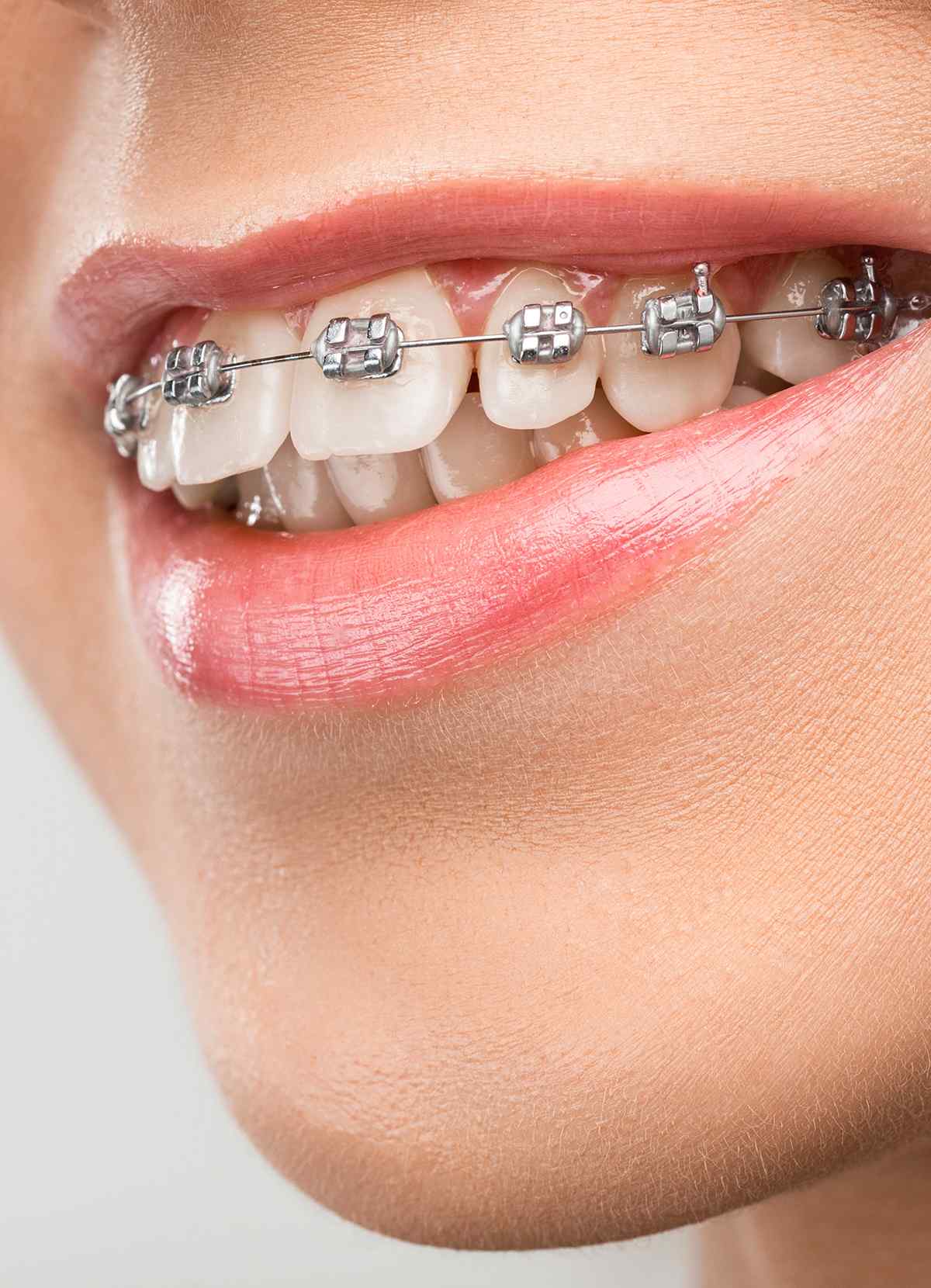 https://smartdentalclinic.com.br/wp-content/uploads/2023/05/inner_image_04-1.jpg