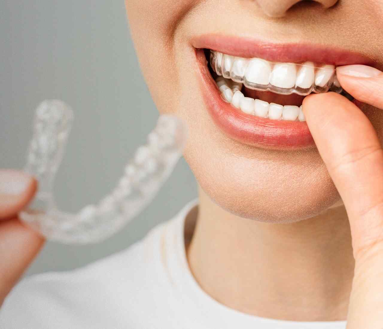 https://smartdentalclinic.com.br/wp-content/uploads/2023/06/hero_services-1280x1100.jpg